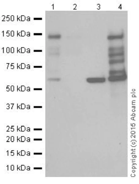 Western blot - Anti-CTCF antibody [EPR18253] - ChIP Grade (AB188408)
