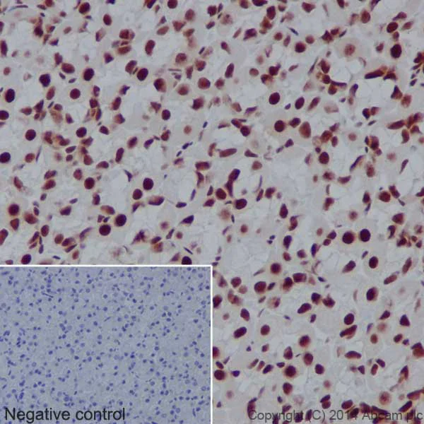 Immunohistochemistry (Formalin/PFA-fixed paraffin-embedded sections) - Anti-CTCF antibody [EPR18253] - ChIP Grade - BSA and Azide free (AB241391)