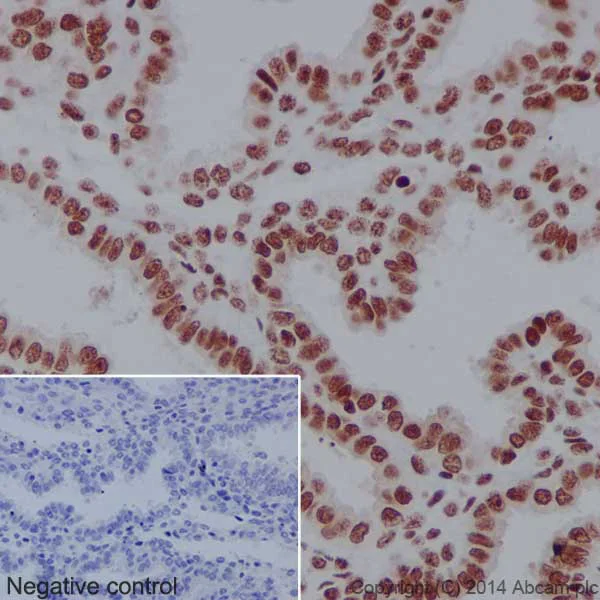 Immunohistochemistry (Formalin/PFA-fixed paraffin-embedded sections) - Anti-CTCF antibody [EPR18253] - ChIP Grade - BSA and Azide free (AB241391)