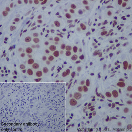 Immunohistochemistry (Formalin/PFA-fixed paraffin-embedded sections) - Anti-CTCF antibody [EPR7314(B)] - ChIP Grade (AB128873)