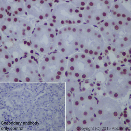 Immunohistochemistry (Formalin/PFA-fixed paraffin-embedded sections) - Anti-CTCF antibody [EPR7314(B)] - ChIP Grade (AB128873)