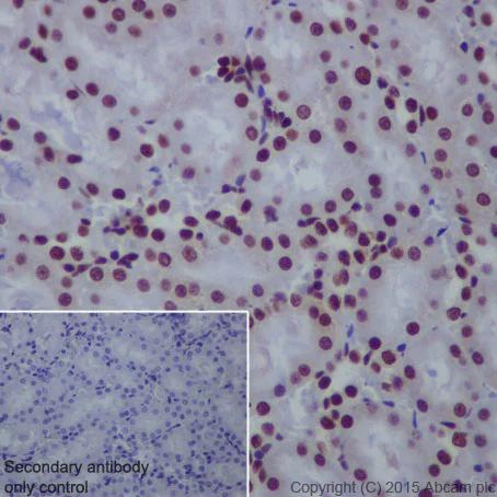 Immunohistochemistry (Formalin/PFA-fixed paraffin-embedded sections) - Anti-CTCF antibody [EPR7314(B)] - ChIP Grade (AB128873)