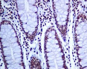 Immunohistochemistry (Formalin/PFA-fixed paraffin-embedded sections) - Anti-CTCF antibody [EPR7314(B)] - ChIP Grade - BSA and Azide free (AB240035)