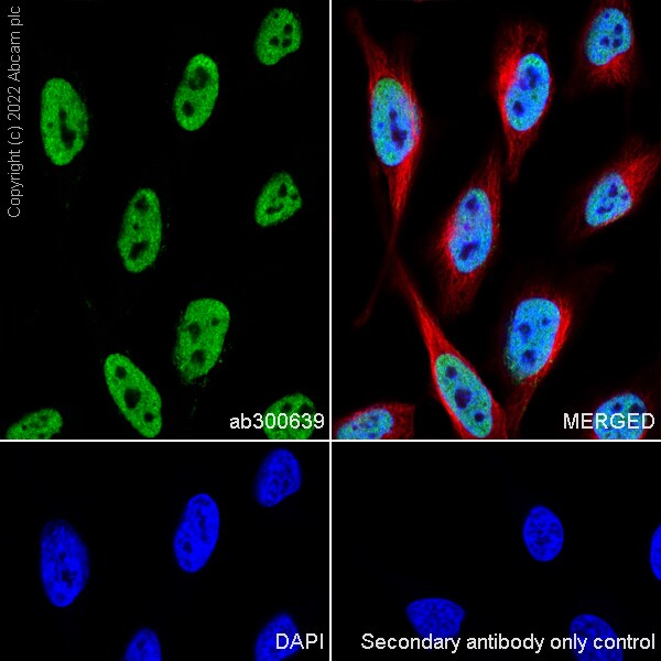 Immunocytochemistry/ Immunofluorescence - Anti-CTCF antibody [RM1044] (ab300639), expandable thumbnail