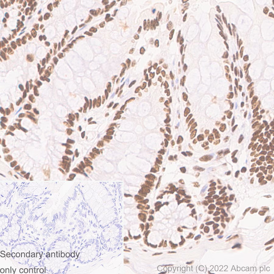 Immunohistochemistry (Formalin/PFA-fixed paraffin-embedded sections) - Anti-CTCF antibody [RM1044] (AB300639), expandable thumbnail
