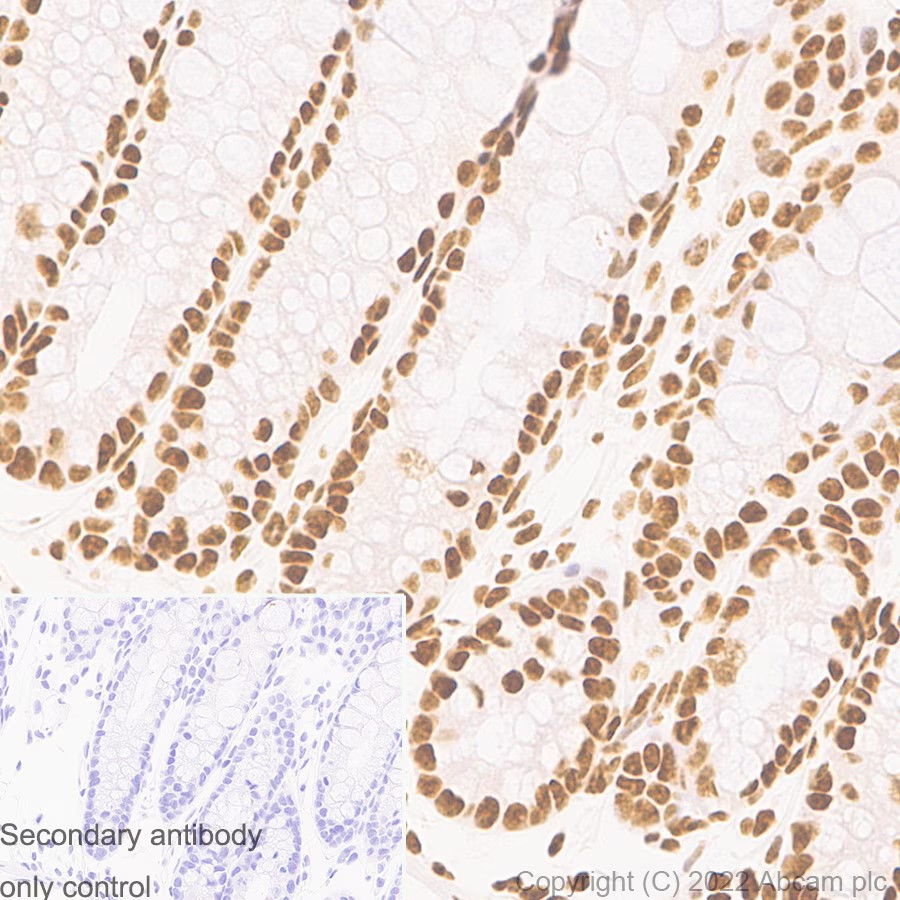 Immunohistochemistry (Formalin/PFA-fixed paraffin-embedded sections) - Anti-CTCF antibody [RM1044] (ab300639), expandable thumbnail
