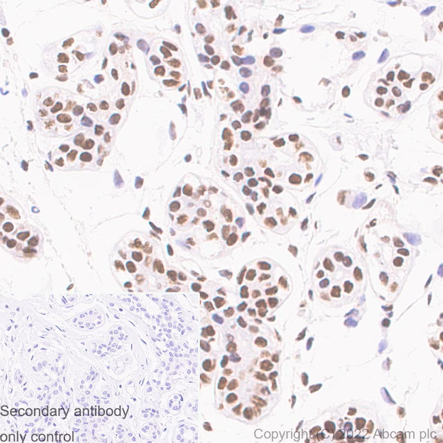 Immunohistochemistry (Formalin/PFA-fixed paraffin-embedded sections) - Anti-CTCF antibody [RM1044] (AB300639), expandable thumbnail