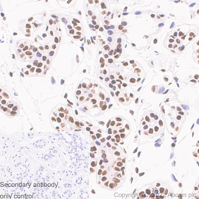 Immunohistochemistry (Formalin/PFA-fixed paraffin-embedded sections) - Anti-CTCF antibody [RM1044] (AB300639)