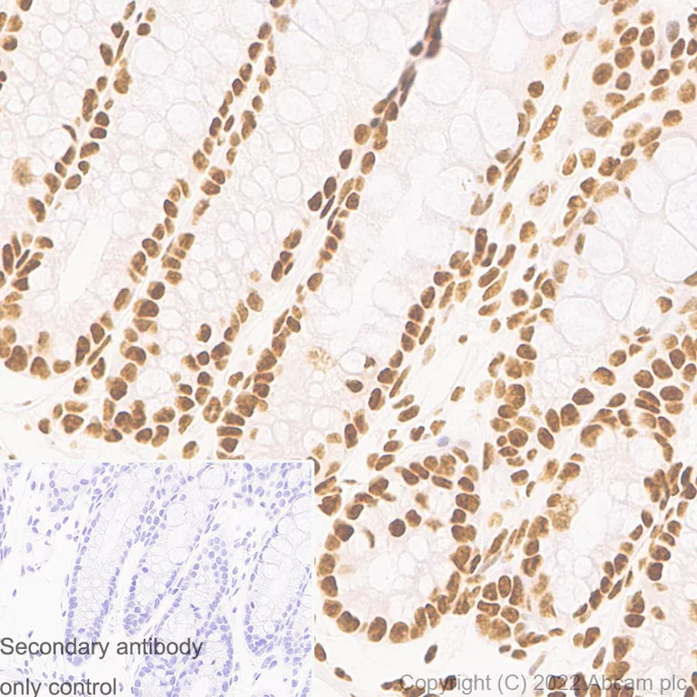 Immunohistochemistry (Formalin/PFA-fixed paraffin-embedded sections) - Anti-CTCF antibody [RM1044] (BSA and Azide free) (AB300640)