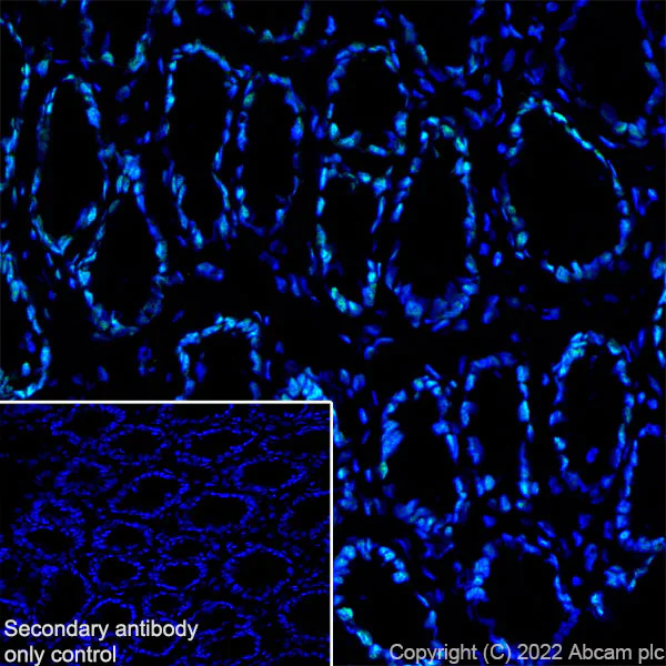 Immunohistochemistry (Frozen sections) - Anti-CTCF antibody [RM1044] (BSA and Azide free) (AB300640)
