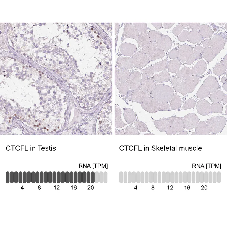 Immunohistochemistry (Formalin/PFA-fixed paraffin-embedded sections) - Anti-CTCFL Antibody (AB327168)