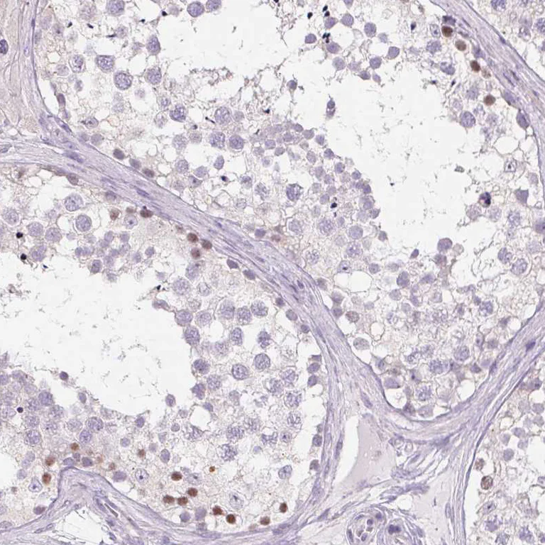 Immunohistochemistry (Formalin/PFA-fixed paraffin-embedded sections) - Anti-CTCFL Antibody (AB327168)