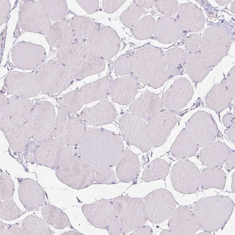 Immunohistochemistry (Formalin/PFA-fixed paraffin-embedded sections) - Anti-CTCFL Antibody (AB327168)