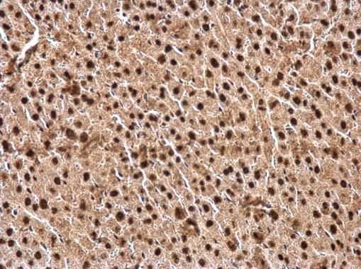 Immunohistochemistry (Formalin/PFA-fixed paraffin-embedded sections) - Anti-CTF/NFIA antibody (AB228897), expandable thumbnail