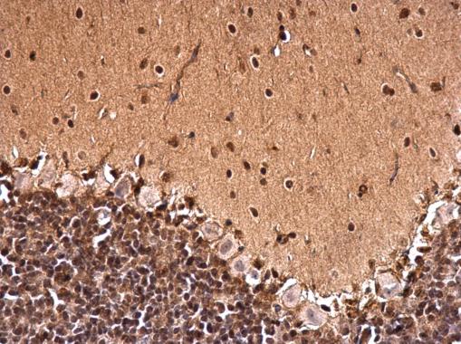 Immunohistochemistry (Formalin/PFA-fixed paraffin-embedded sections) - Anti-CTF/NFIA antibody (ab228897), expandable thumbnail