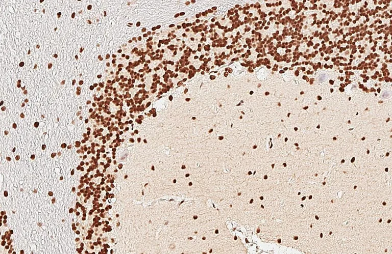 Immunohistochemistry (Formalin/PFA-fixed paraffin-embedded sections) - Anti-CTF/NFIA antibody (AB228897)