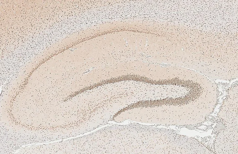 Immunohistochemistry (Formalin/PFA-fixed paraffin-embedded sections) - Anti-CTF/NFIA antibody (AB228897)