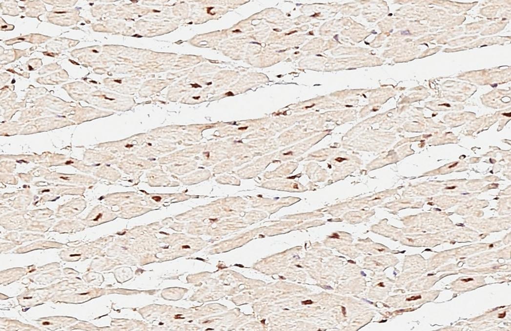 Immunohistochemistry (Formalin/PFA-fixed paraffin-embedded sections) - Anti-CTF/NFIA antibody (AB228897)