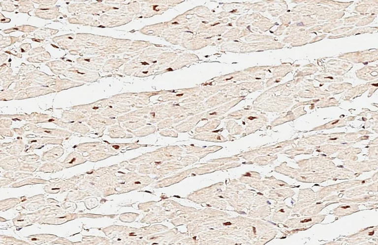 Immunohistochemistry (Formalin/PFA-fixed paraffin-embedded sections) - Anti-CTF/NFIA antibody (AB228897)