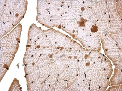 Immunohistochemistry (Formalin/PFA-fixed paraffin-embedded sections) - Anti-CTF/NFIA antibody (AB228897), expandable thumbnail