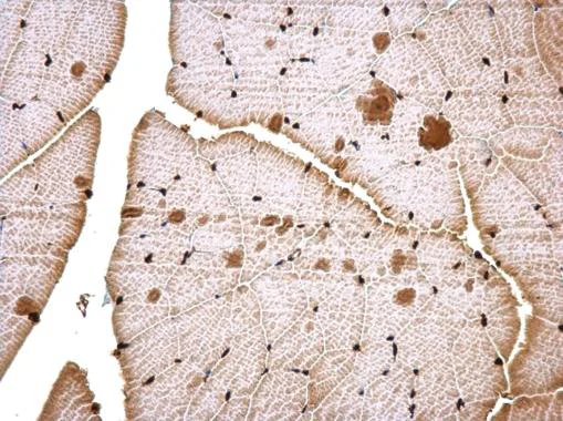 Immunohistochemistry (Formalin/PFA-fixed paraffin-embedded sections) - Anti-CTF/NFIA antibody (AB228897)