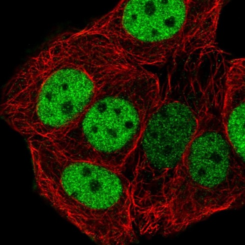 Immunocytochemistry/ Immunofluorescence - Anti-CTF18 antibody (AB220288), expandable thumbnail