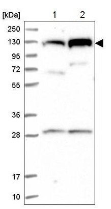Western blot - Anti-CTF18 antibody (AB220288), expandable thumbnail