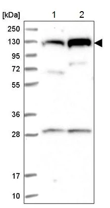 Western blot - Anti-CTF18 antibody (AB220288)