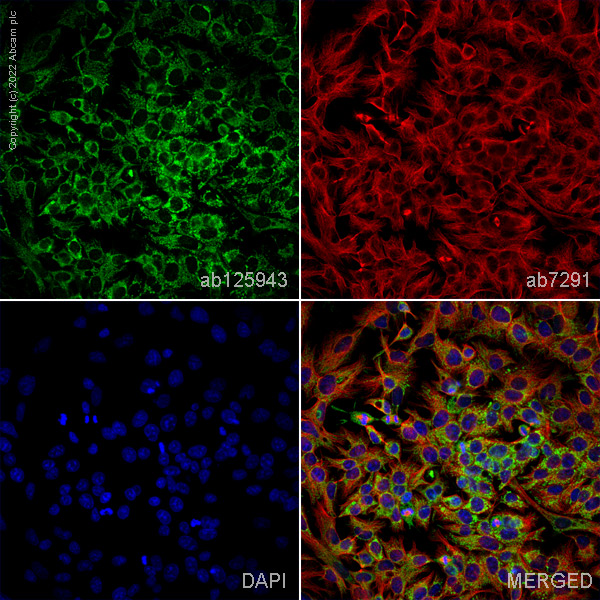 Immunocytochemistry/ Immunofluorescence - Anti-CTGF antibody (AB125943)