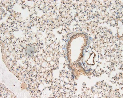 Immunohistochemistry (Formalin/PFA-fixed paraffin-embedded sections) - Anti-CTGF antibody (AB125943)