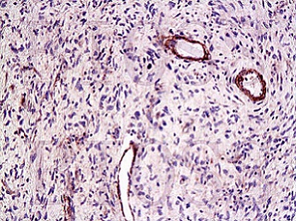 Immunohistochemistry (Formalin/PFA-fixed paraffin-embedded sections) - Anti-CTGF antibody (AB227180)