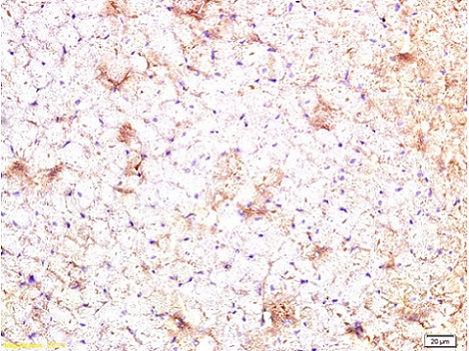 Immunohistochemistry (Formalin/PFA-fixed paraffin-embedded sections) - Anti-CTGF antibody (AB227180)