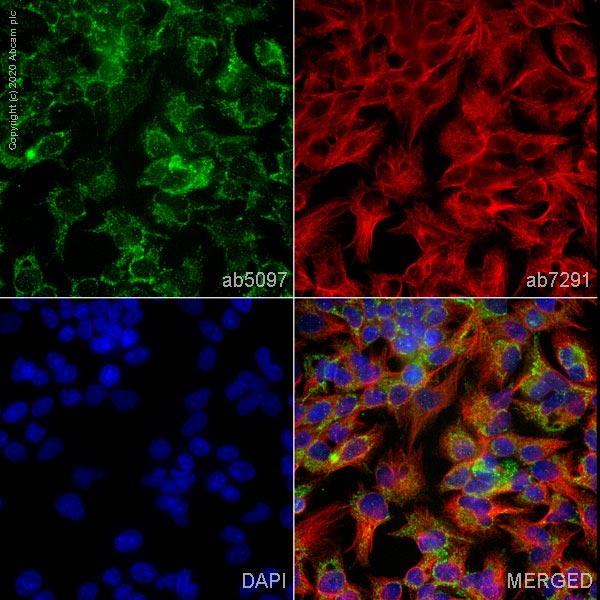 Immunocytochemistry - Anti-CTGF antibody (AB5097)