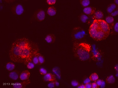 Immunocytochemistry - Anti-CTGF antibody (AB5097)