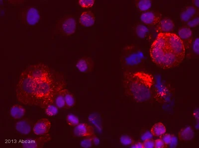 Immunocytochemistry - Anti-CTGF antibody (AB5097)