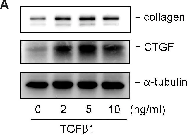 Western blot - Anti-CTGF antibody (AB6992)