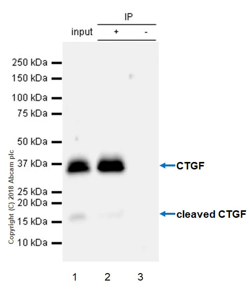 Immunoprecipitation - Anti-CTGF antibody [EPR20728] - BSA and Azide free (AB231824)