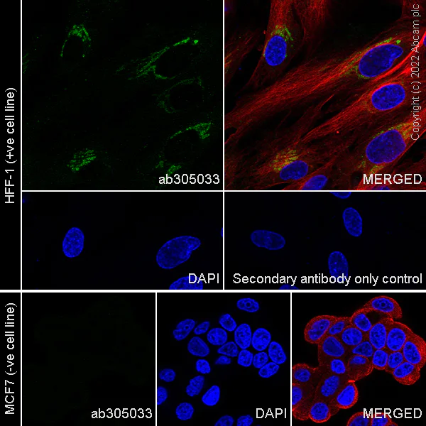 Immunocytochemistry/ Immunofluorescence - Anti-CTGF antibody [EPR26521-6]- BSA and Azide free (AB305034)