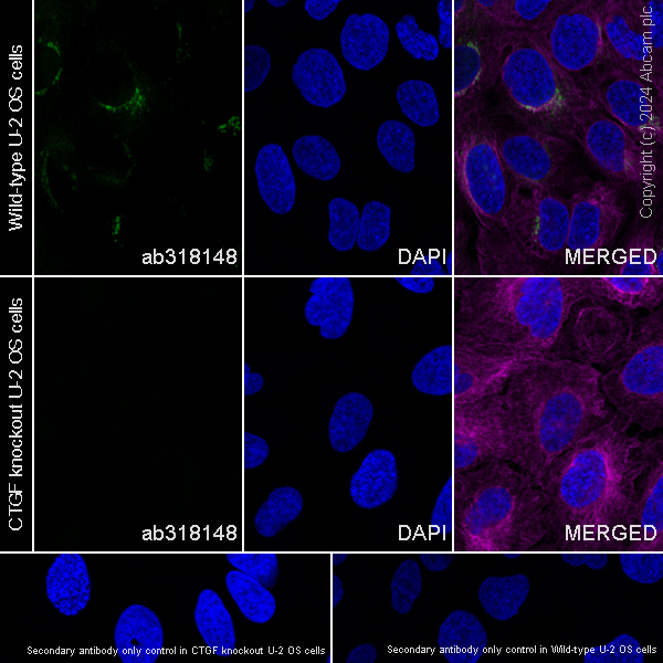 Immunocytochemistry/ Immunofluorescence - Anti-CTGF antibody [RM1199] (AB318148), expandable thumbnail