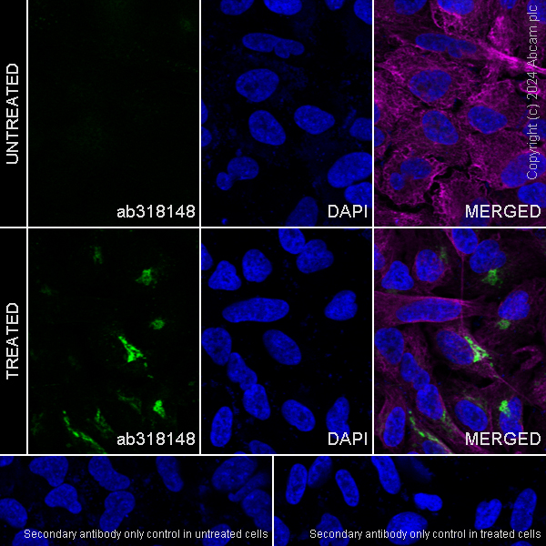 Immunocytochemistry/ Immunofluorescence - Anti-CTGF antibody [RM1199] (AB318148), expandable thumbnail