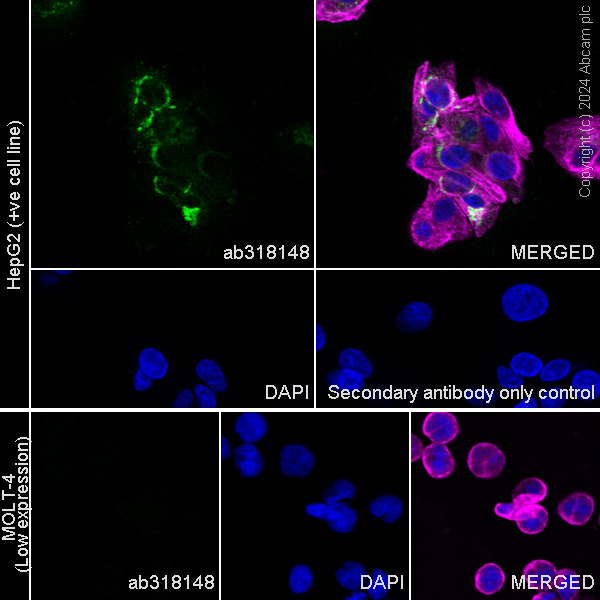 Immunocytochemistry/ Immunofluorescence - Anti-CTGF antibody [RM1199] (AB318148), expandable thumbnail