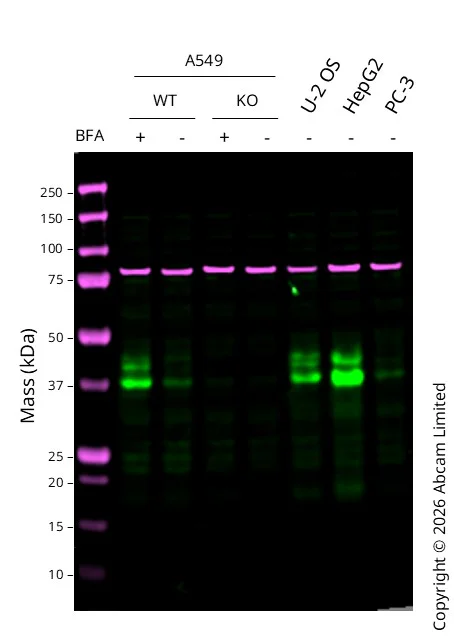 Western blot - Anti-CTGF antibody [RM1199] (AB318148)