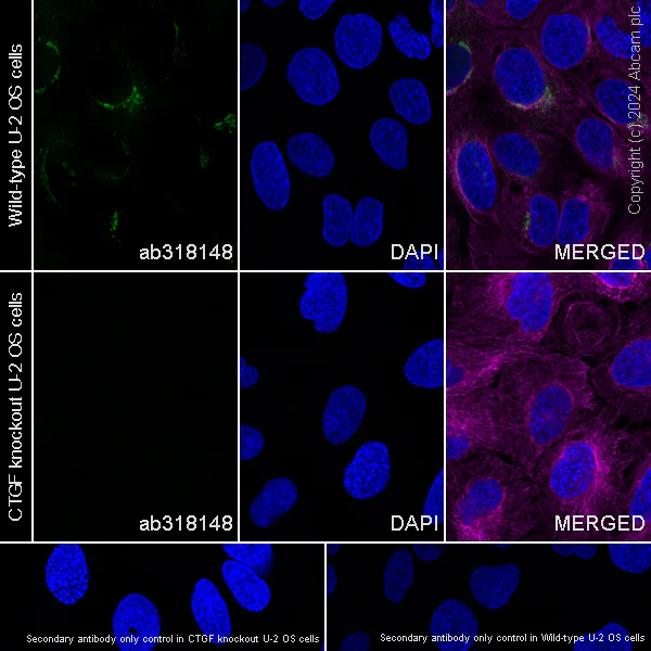 Immunocytochemistry/ Immunofluorescence - Anti-CTGF antibody [RM1199] - BSA and Azide free (AB318149)