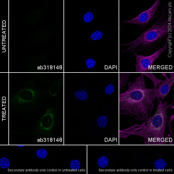 Immunocytochemistry/ Immunofluorescence - Anti-CTGF antibody [RM1199] - BSA and Azide free (AB318149)
