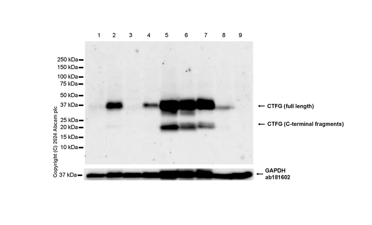 Western blot - Anti-CTGF antibody [RM1199] - BSA and Azide free (AB318149)
