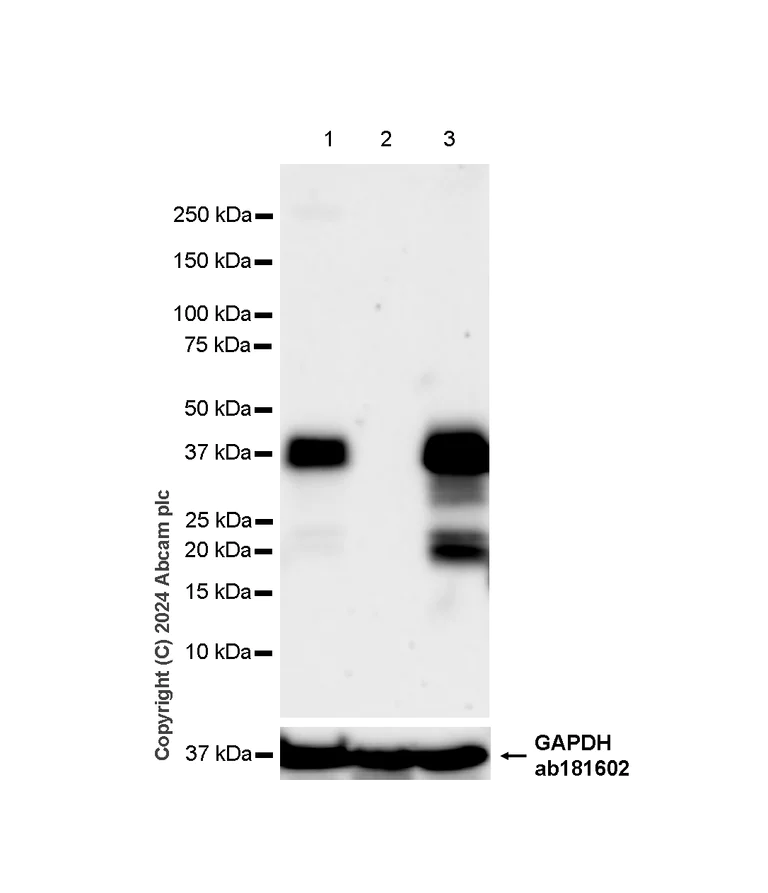 Western blot - Anti-CTGF antibody [RM1199] - BSA and Azide free (AB318149)