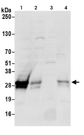 Western blot - Anti-CTHRC1 antibody (AB264411)