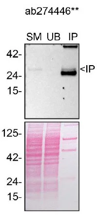 Immunoprecipitation - Anti-CTHRC1 antibody [EPR22851-144] - BSA and Azide free (Capture) (AB274446)