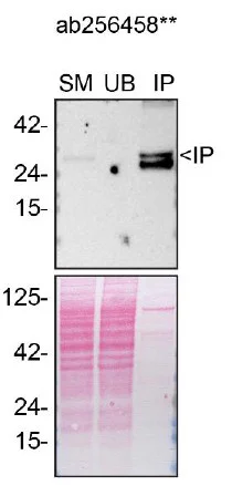 Immunoprecipitation - Anti-CTHRC1 antibody [EPR22851-145] (AB256458)