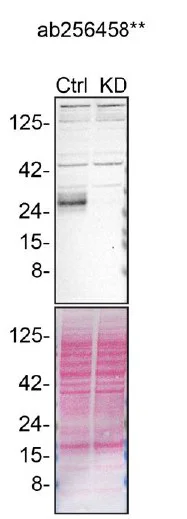 Western blot - Anti-CTHRC1 antibody [EPR22851-145] (AB256458)